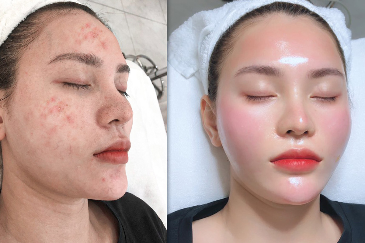 khach-tre-hoa https://dieutrida.com/wp-content/uploads/2026/04/khach-tre-hoa.jpg